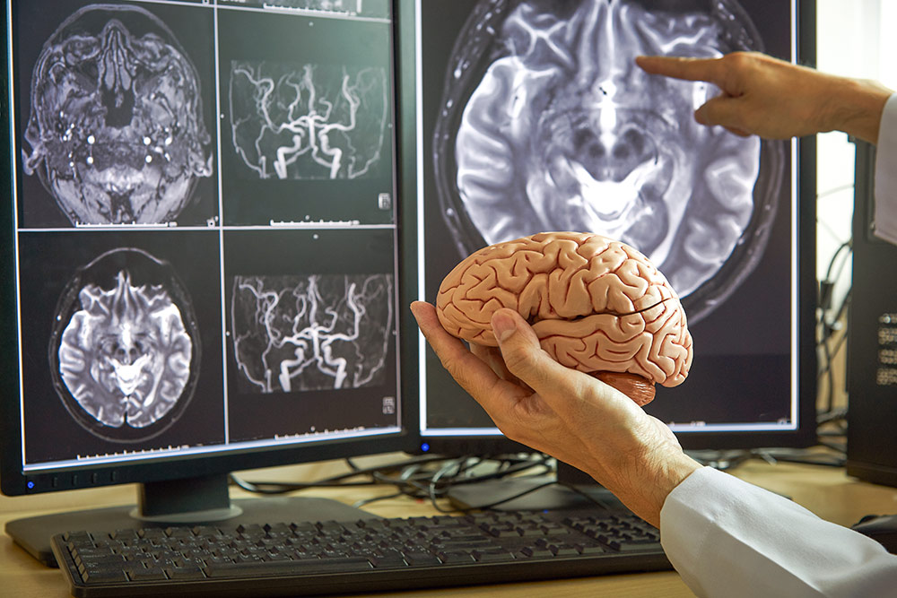 22 lipca – Światowy Dzień Mózgu. Innowacyjne podejście do diagnostyki oraz terapie chorób mózgu ratują życie i poprawiają jego jakość