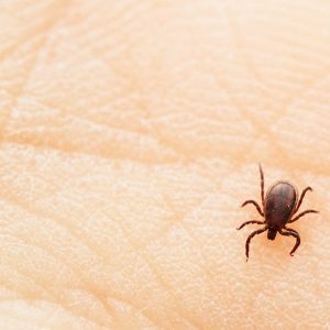 Tick is crawling on the human palm